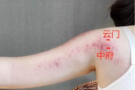 每天3分钟，打通这条经络，活气血、排淤堵，大病小病难上身！