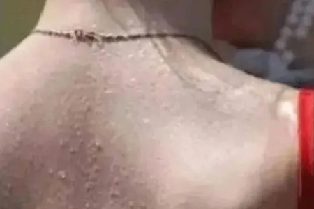 三伏不排毒，一年身体堵！借助天时这样晒背，拔出陈年寒湿毒（最全晒背指南）
