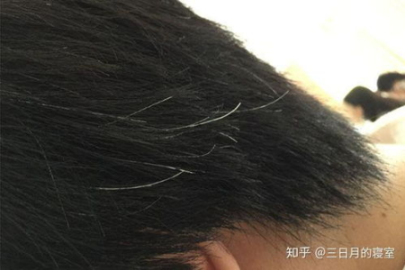 白发越长越多，原来是脏腑出了问题！3个方法照着做，补肝肾，益精血！