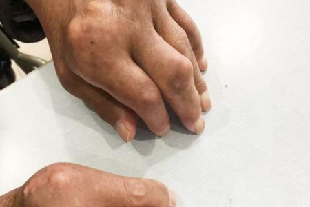 哈佛大学最新研究揭示：6类食物助力降低全身炎症，预防多种癌症