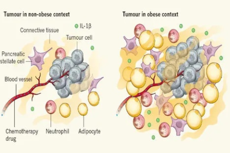 Nature最新研究：你扔不掉的“健康糖”，正在给肿瘤充能