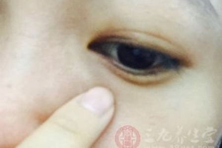 眼睛散光如何治疗才能恢复正常视力？