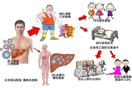 远离戊肝，先了解它的传播途径和预防方法