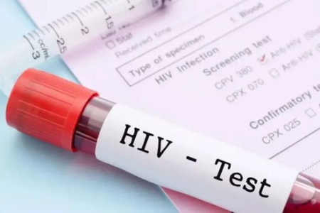 你知道艾滋病是怎么传染的吗？避免感染的实用指南