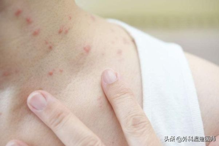 艾滋病发病期症状详解：从早期到晚期有哪些表现？