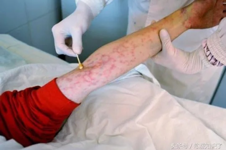 我可能得了艾滋病吗？症状自查及医院检查指南