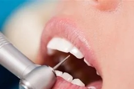 洗牙真的会传染艾滋病吗？如何避免洗牙感染风险？