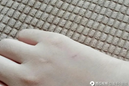 猫抓伤有划痕还鼓起来？教你如何正确处理伤口和预防疾病！