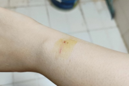 幼猫咬伤，伤口浅出血，狂犬病风险大不大？该怎么处理？