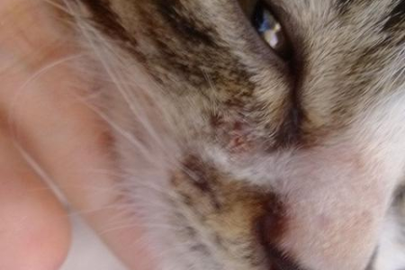 猫藓会传染给人吗？人得了猫藓的症状表现