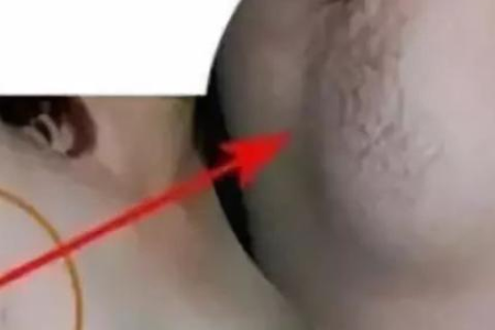 猫咪背上肿块是皮肤病还是其他疾病？
