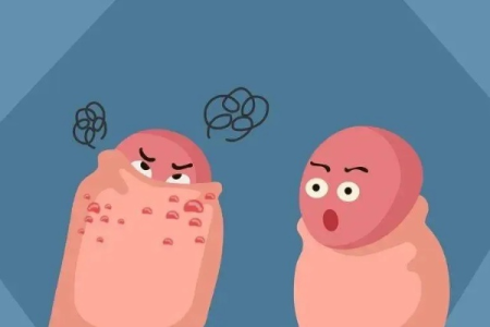男生下体长小疙瘩别慌！皮肤性病科医生教你如何应对