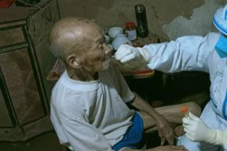 普外科老人体温35.5度正常吗？低体温原因及应对方法