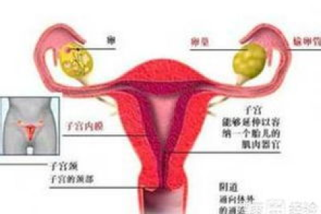 心血管内科：感染性心内膜炎的症状及表现是什么？
