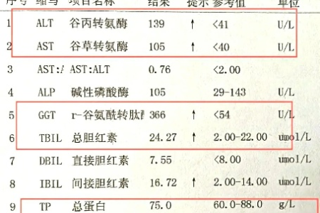 谷丙转氨酶升高：肝胆疾病的治疗及预防方法
