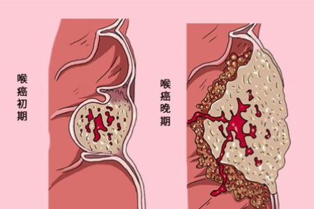 肿瘤生物治疗与传统治疗一样吗？效果有差异吗？