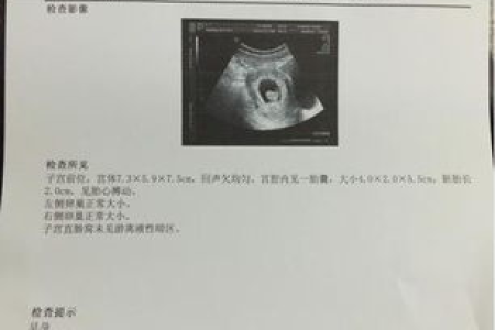 妇产科孕6周B超单数据解读：孕囊大小、胎芽胎心怎么看？