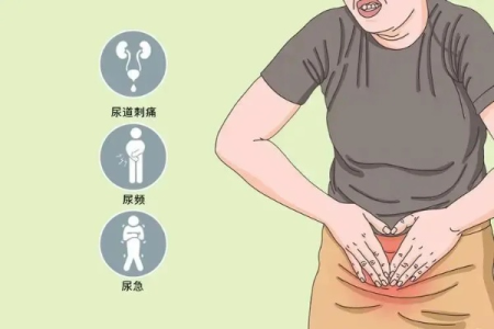 女性尿频尿急尿痛，与前列腺疾病有关吗？