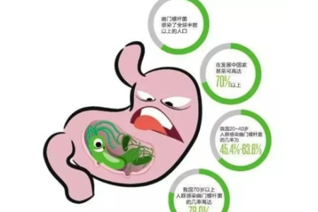 幽门螺旋杆菌感染的症状有哪些？这些消化道不适要注意！