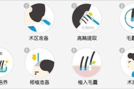 整形外科医生常用卷发棒？会脱发吗？真相在这里！