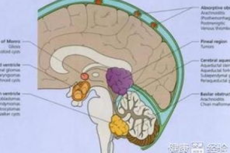 神经内科颅内压增高是什么原因？哪些疾病会导致颅内压增高？