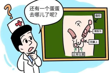 想上环？妇产科医生提醒你：潜在的危害和影响不容忽视！