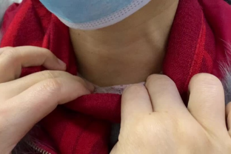 内分泌科医生怎么说？甲状腺4A类结节要不要手术？