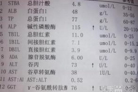 肝功能不好谷丙转氨酶偏高，哪些食物可以帮助降低？