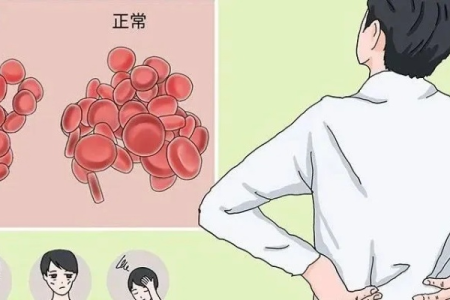 肾脏疾病导致严重贫血的症状有哪些？