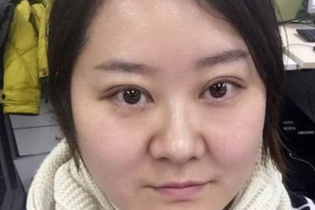 双眼皮手术前准备：术前检查和注意事项大全