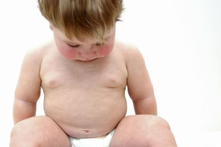 宝宝出生半个月拉肚子如何处理？消化内科专家支招