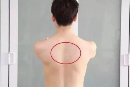 肩胛骨疼痛是哪三种病？骨科医生告诉你！