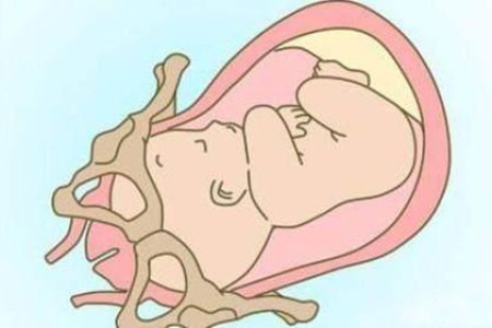 胎儿入盆后大概多久出生？初产妇与经产妇生产时间有区别吗？