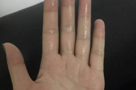 外科脚有冰凉感觉是怎么回事？小心这些疾病藏在其中！