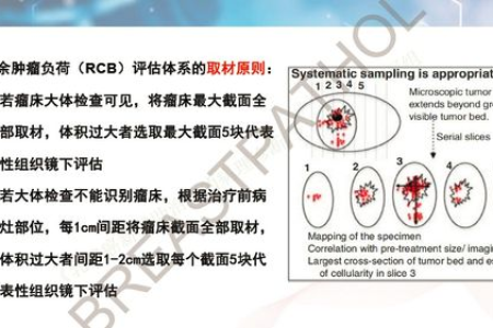 肿瘤科专家解读：乳腺癌新辅助内分泌治疗原则
