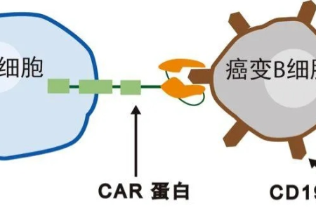 CAR-T免疫疗法：能治疗哪些类型的癌症？