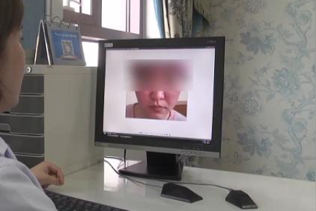 皮肤科医生解答：皮肤遇冷发痒发红是什么疾病？如何治疗？