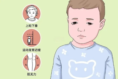 如何判断神经内科疾病进行性肌营养不良的症状？