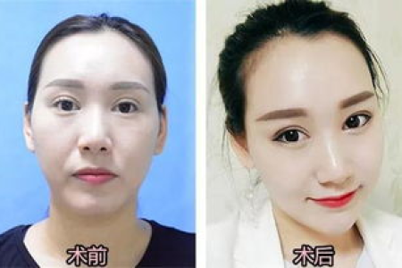 整形美容玻尿酸：护肤品作用大揭秘，潜在危害你了解吗？