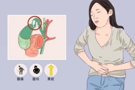 妊娠合并急性胆囊炎的症状表现有哪些？如何预防？