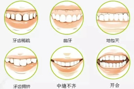 口腔科成年了还可以做牙齿矫正吗？成年人牙齿矫正的优缺点分析
