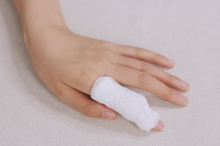 皮肤性病科剥脱性角质松解症是什么病？症状有哪些？如何治疗？