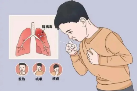呼吸内科肺炎临床表现详解：常见症状及应对方法