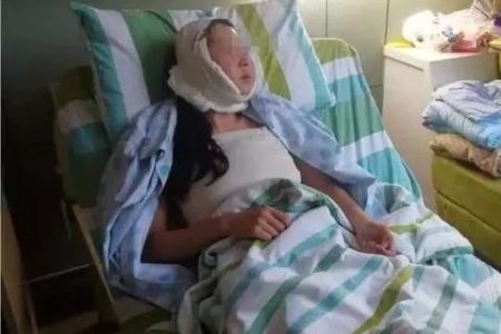 开眼角手术费用是多少？不同医院价位有差异吗？