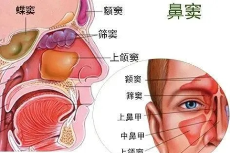 副鼻窦炎与鼻窦炎有什么区别？医生怎么说？
