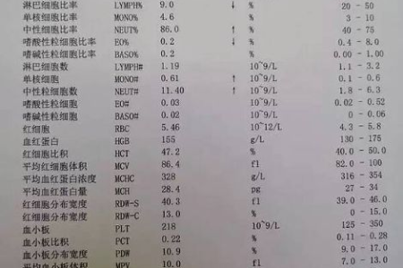 血液内科：单核细胞百分比偏高，需要警惕什么？