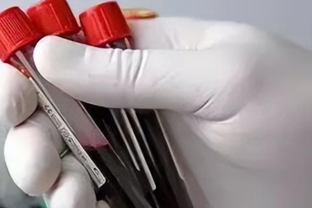 中医养生科普：梅毒特异性与非特异性抗体检查差异
