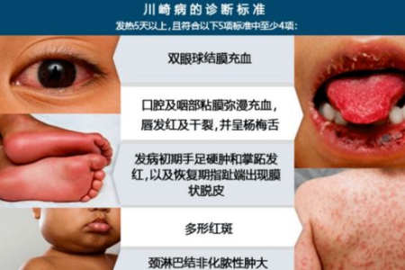 中医养生：肺热有哪些典型症状？怎样才能彻底根治？