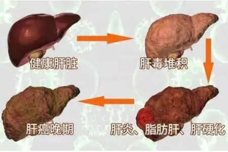 中医养生：身体这些症状可能暗示你的肝脏不好
