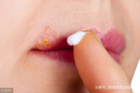嘴唇起泡上火了怎么办？中医养生教你快速消除